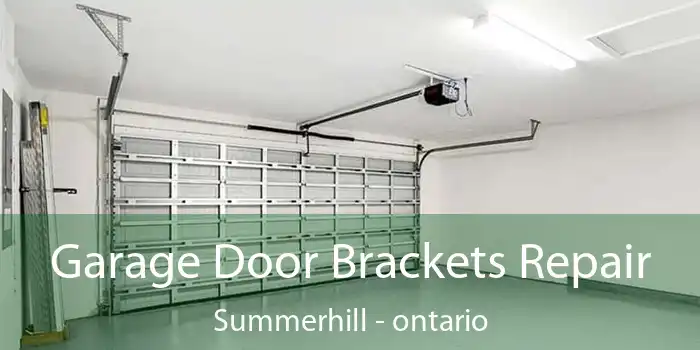 Garage Door Brackets Repair Summerhill - ontario