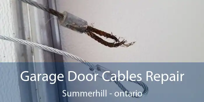 Garage Door Cables Repair Summerhill - ontario