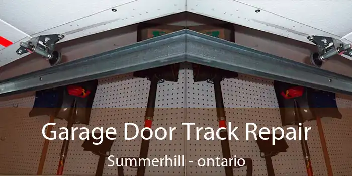 Garage Door Track Repair Summerhill - ontario